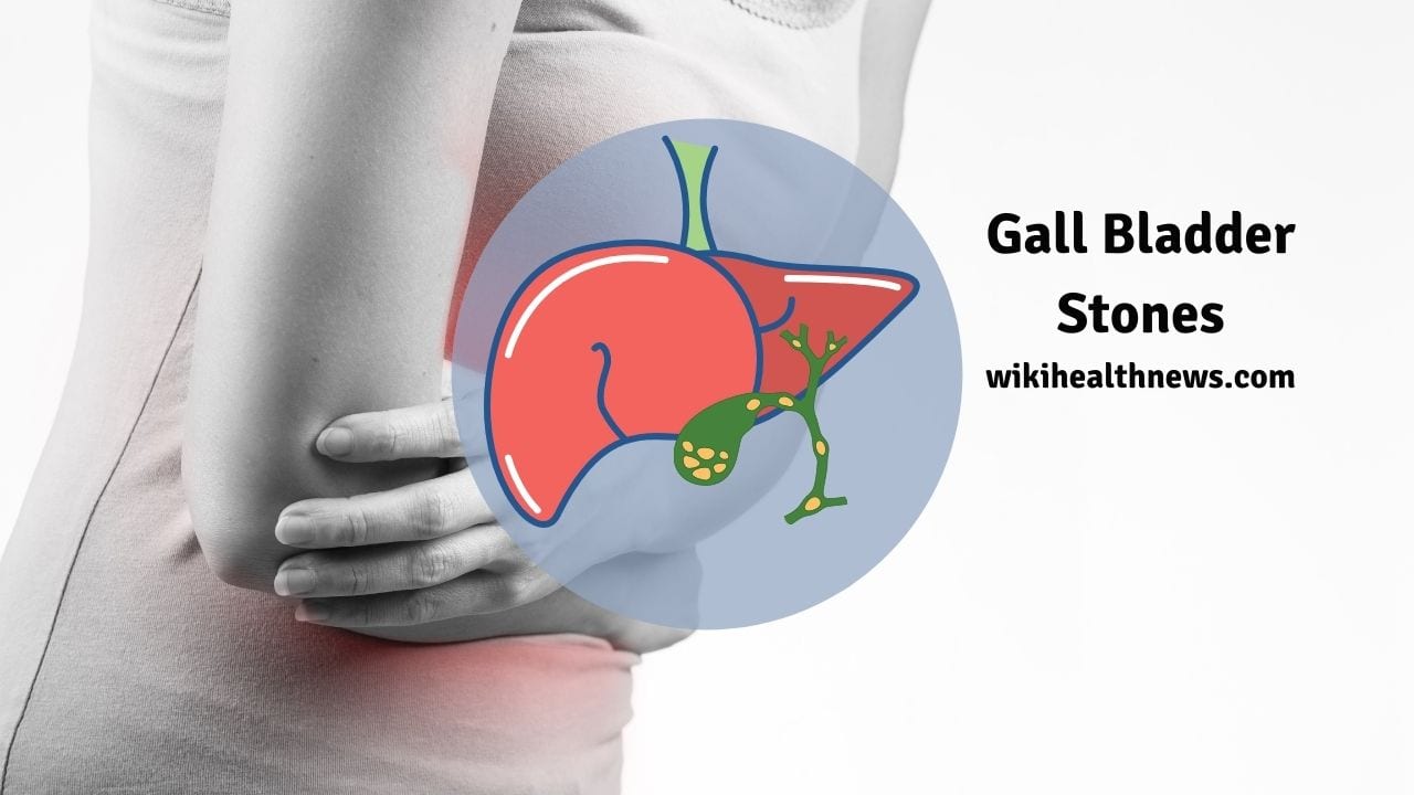 How to Prevent Gall Bladder Stones? - wiki Health News