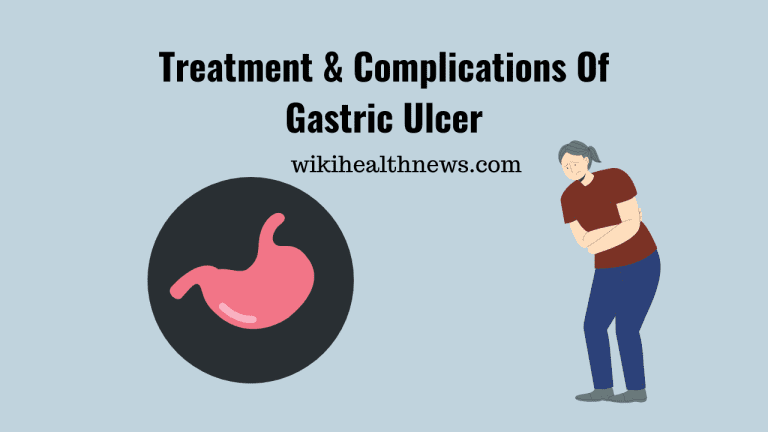 Treatment & Complications Of Gastric Ulcer - wiki Health News