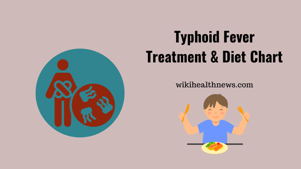 Typhoid Fever Food Chart Treatment Wiki Health News