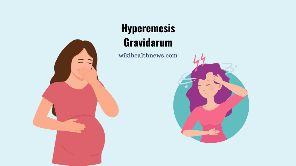 hyperemesis-gravidarum-needs-medical-help-wiki-health-news