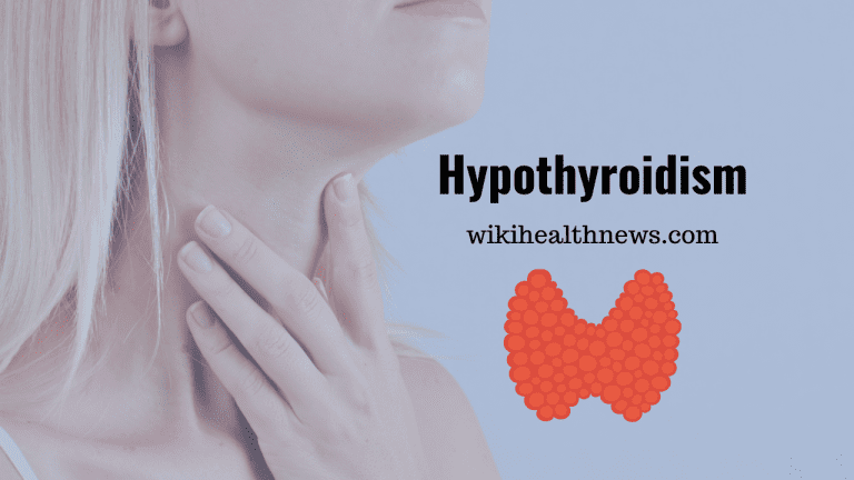 Hypothyroidism: Underactive Thyroid Gland - Wiki Health News