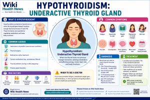 Hypothyroidism: Underactive Thyroid Gland