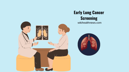 Early Lung Cancer Screening