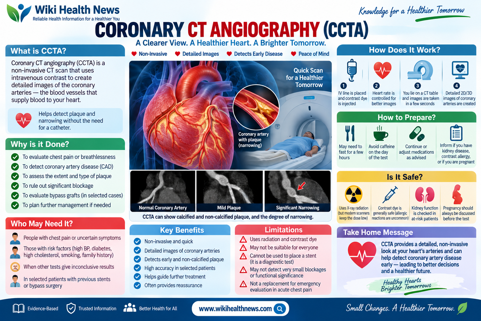 Coronary CT Angiography