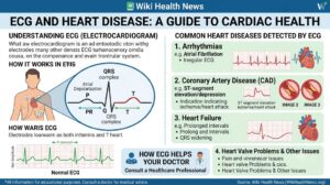 ECG and Heart Disease: What an ECG Can Tell You About Your Heart