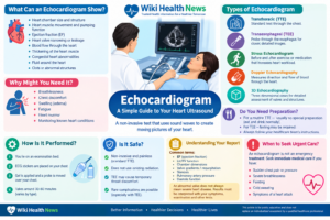 Echocardiogram: A Simple Guide to Your Heart Ultrasound